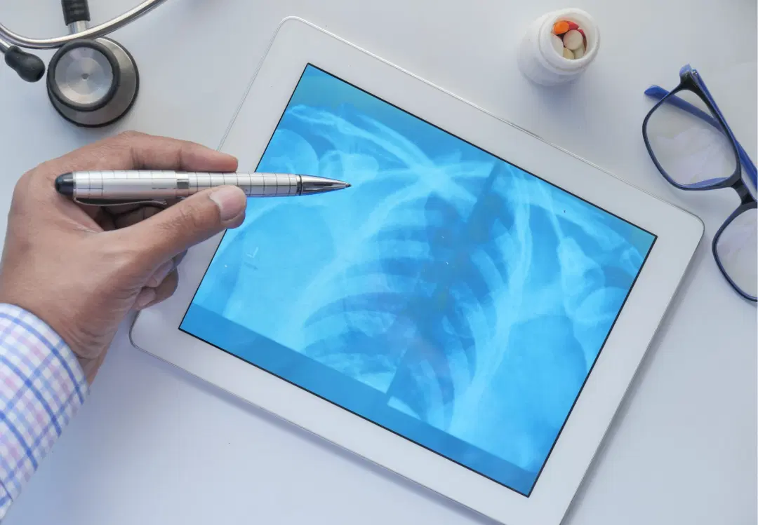 Driving Launch Success with KOL Mapping in Digital Health - Case Study